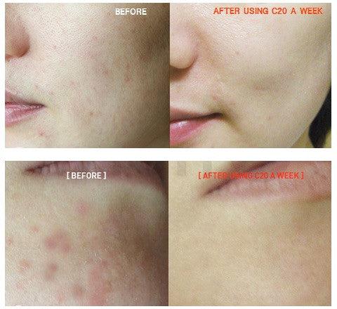 Suero de Pura Vitamina C deTIAM nature [Pure Vitamin C20 Serum]